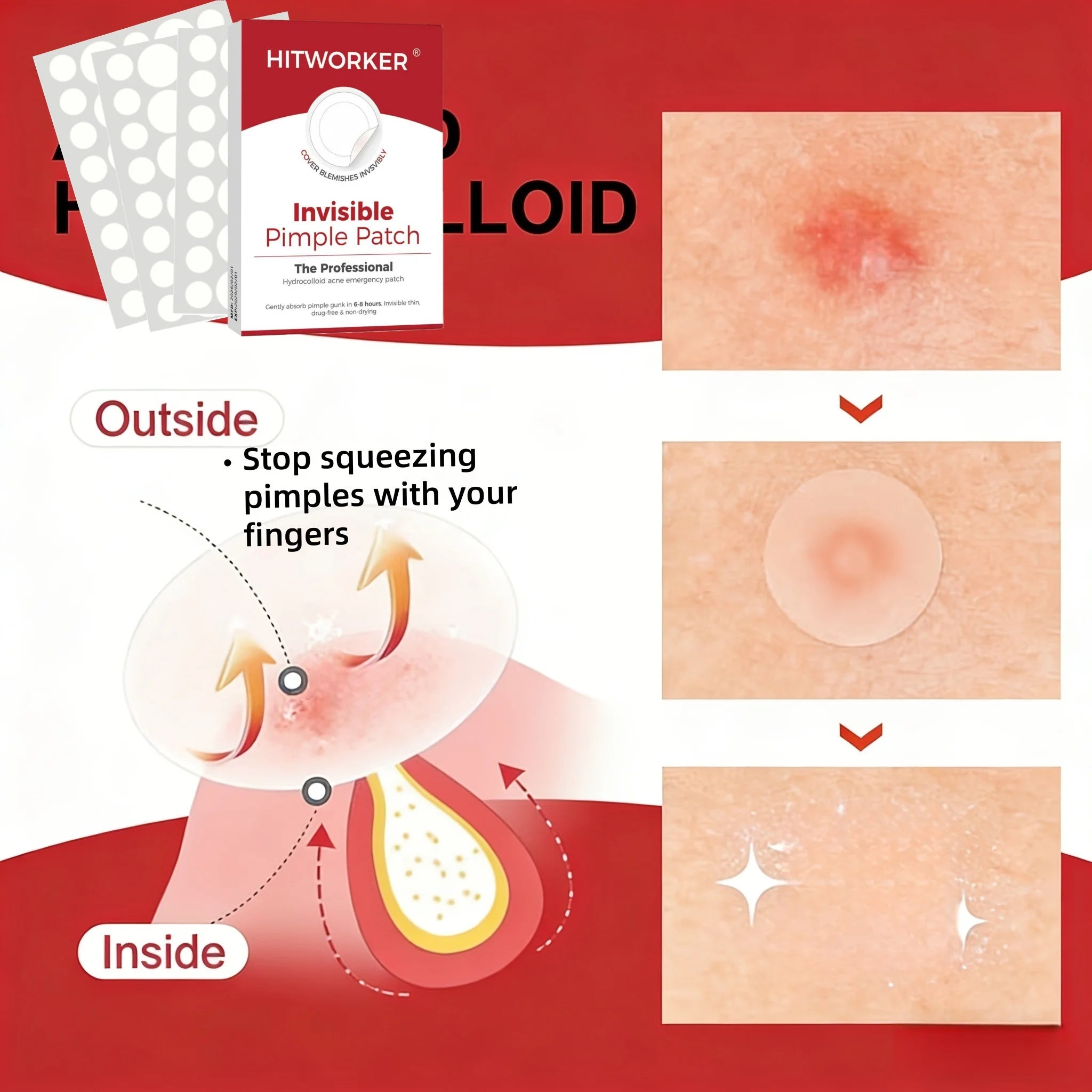 360/540/720PCS Acne Patches